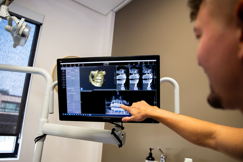 dr raz showing implant placement digitally
